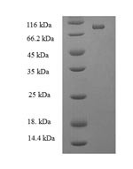 ATP-dependent RNA helicase DDX19A (DDX19A), human, recombinant