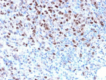 Anti-MITF, clone MITF/2987R