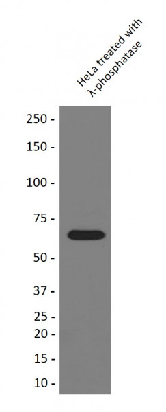Anti-phospho-PAK1 + PAK2 + PAK3 (Ser144 / Ser141 / Ser154)