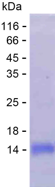 Recombinant Human SLCO6A1 Protein