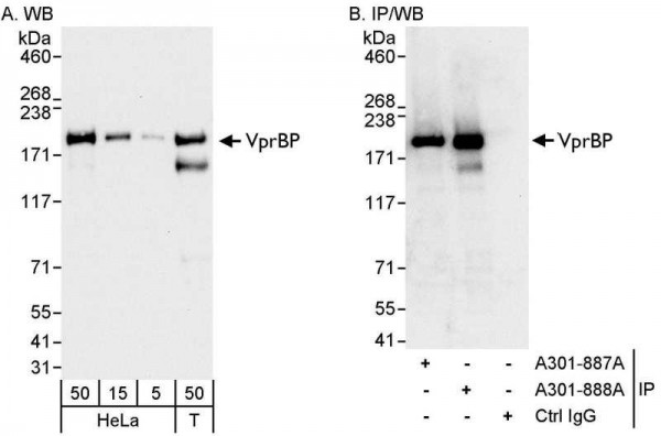 Anti-VprBP