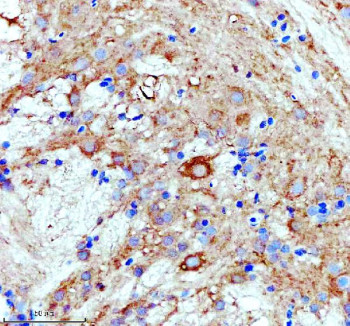 Anti-Zebrafish Luteinizing hormone beta / Lhb