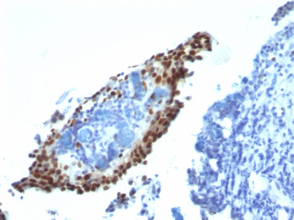 Anti-p21WAF1 (Tumor Suppressor Protein), clone HJ21