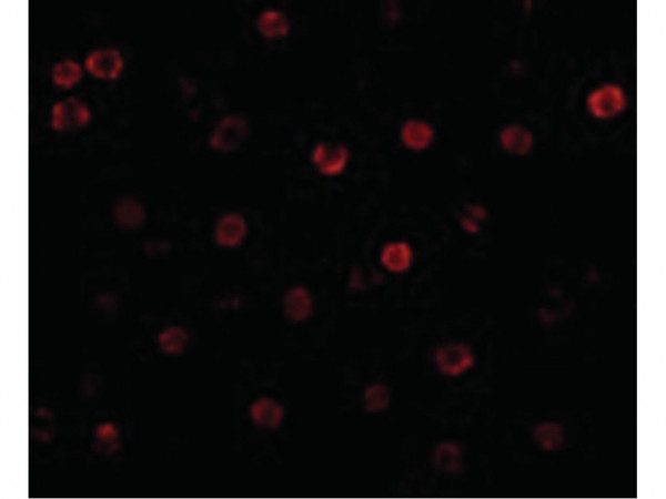 Anti-T-cadherin