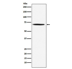 Anti-PDC-E2 / Pyruvate Dehydrogenase E2, clone 23D09