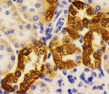 Anti-CD151