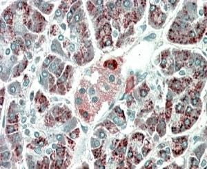 Anti-PEBP4