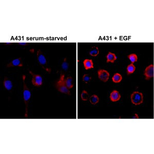 Anti-Phosphotyrosine, Rabbit Monoclonal (RM111)