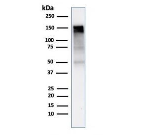 Anti-EGF Receptor / EGFR, clone rGFR/1667