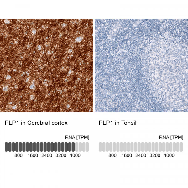 Anti-PLP1, clone CL10622