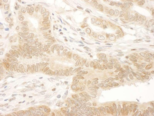 Anti-NARG1 (IHC)