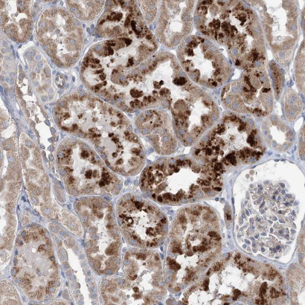 Anti-SCN11A