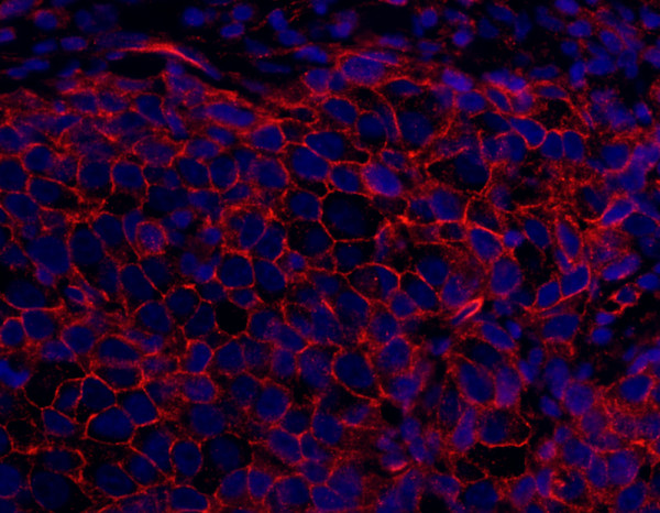 Anti-SPTAN1/Alpha II-spectrin