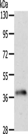Anti-SIRT2