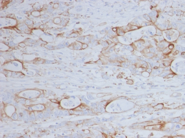 Anti-CD151, clone 11G5a