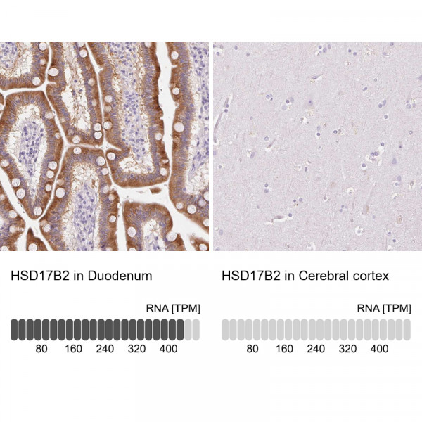 Anti-HSD17B2