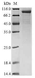Complement C1s subcomponent (C1S), human, recombinant