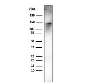 Anti-Caldesmon / CALD1 / CAD (HMW), clone rCALD1/820