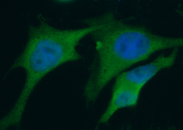 Anti-S100A6 Monoclonal Antibody