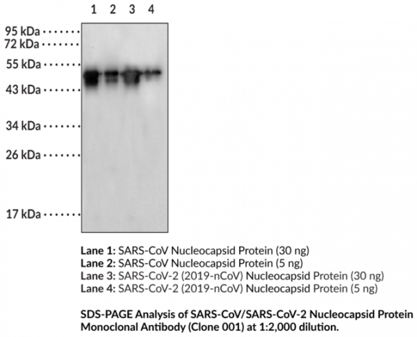 Anti-SARS-CoV/SARS-CoV-2 Nucleocapsid Protein (Monoclonal Rabbit Clone 001)