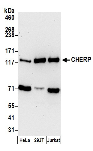 Anti-CHERP
