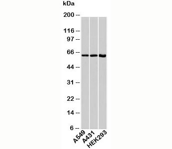 Anti-HSP60