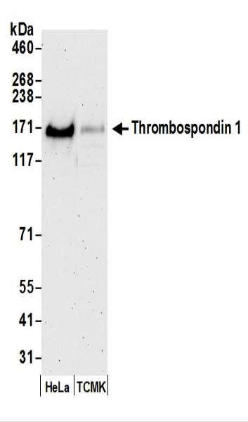 Anti-Thrombospondin 1/THBS1
