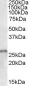 Anti-SMN1 / SMN2, Internal