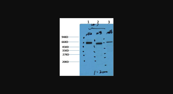 Anti-CK7, monoclonal