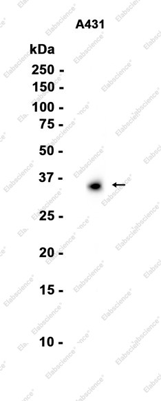 Anti-Recombinant Tartrate Resistant Acid Phosphatase, clone C113149