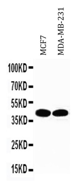 Anti-TBP / TATA Binding Protein