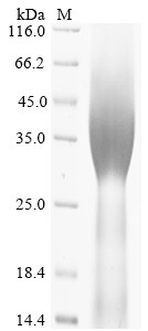 Homeobox protein Hox-A3 (HOXA3), human, recombinant