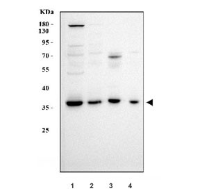 Anti-APOBEC3B / A3B