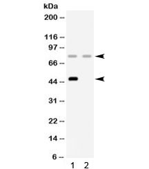 Anti-Complement Factor I / CFI