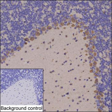 Anti-Lgi4