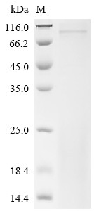 Inactive tyrosine-protein kinase 7 (Ptk7),partial, mouse, recombinant