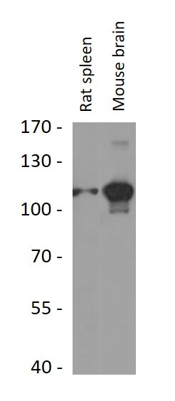 Anti-NCSTN / Nicastrin