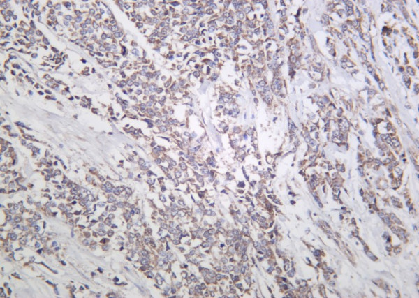 Anti-Recombinant Actinin-alpha1, clone 4D11