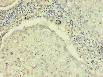 Anti-RRM1 Monoclonal, clone 3D6H5