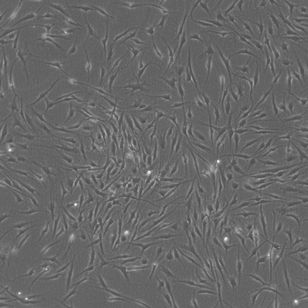 Human Mesenchymal Stem Cells - Bone Marrow (HMSC-BM)