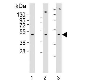Anti-ADRA2B / Alpha-2B Adrenergic Receptor