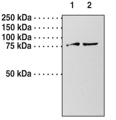 Anti-Guanylate Cyclase alpha