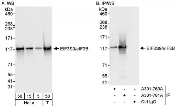 Anti-eIF3B/EIF3S9