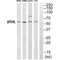 Anti-IPPK