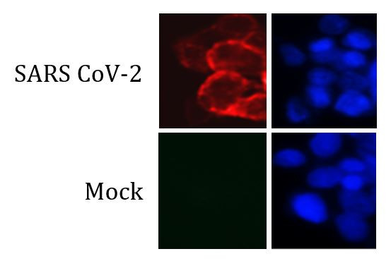 Anti-SARS-CoV-2 Spike protein (RBD), clone SQab20178
