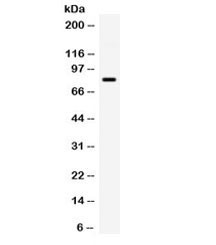 Anti-GRK3 / ADRBK2