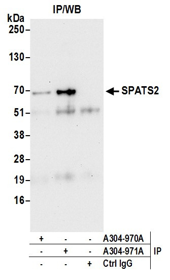 Anti-SPATS2/SPATA10