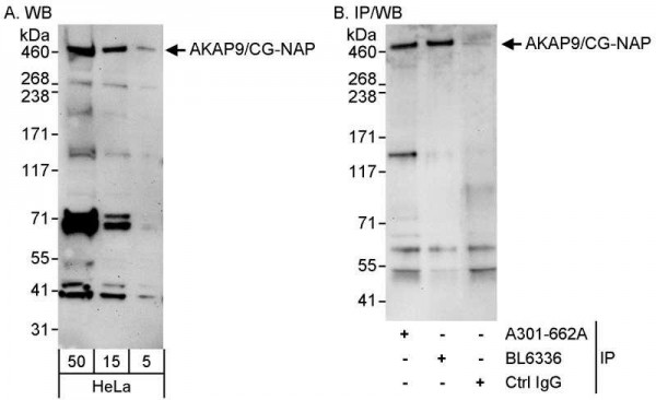 Anti-AKAP9/CG-NAP