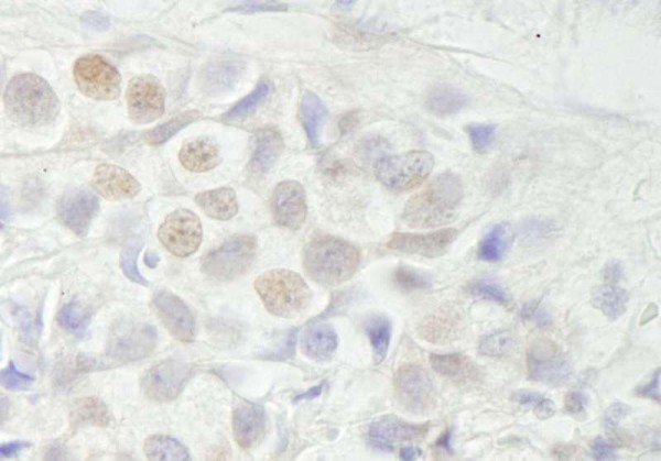 Anti-BCAS3 (IHC)