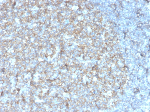 Anti-CD81 / TAPA-1, recombinant antibody, clone rC81/3442
